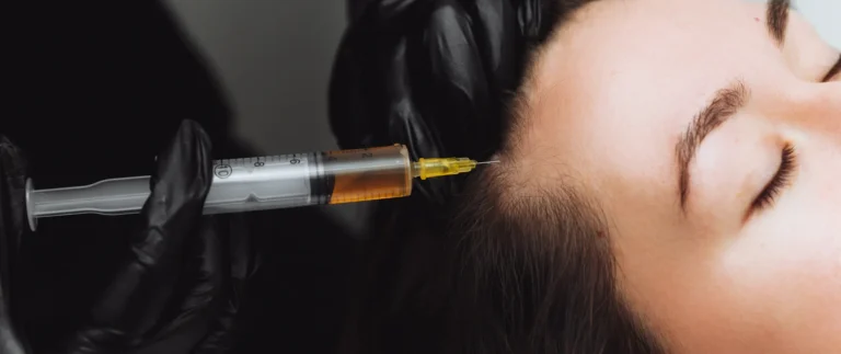 Hair Restoration Injection